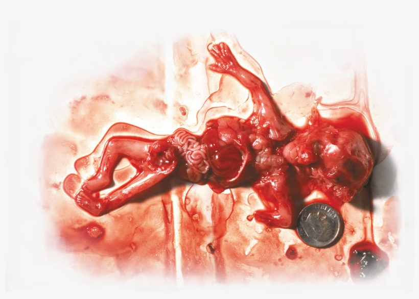 However You Do Have A Right To Stop Having Unproctected - Not Your Body Abortion Meme, transparent png #7947