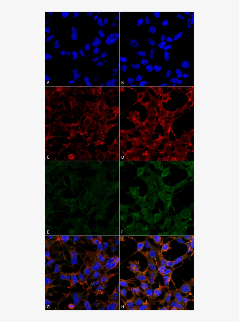 Smc 511 4 Hydroxynonenal Antibody 12f7 Icc If Human - 4 Hne Immunohistochemistry, transparent png #1005593