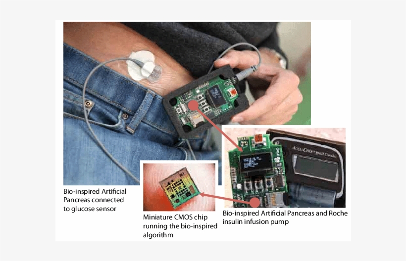 The Bio-inspired Artificial Pancreas - Electronic Component, transparent png #10061438