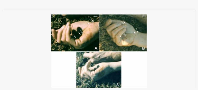 The Right Hand Of The Victim From Death Scene Photographs - Ring, transparent png #1012307