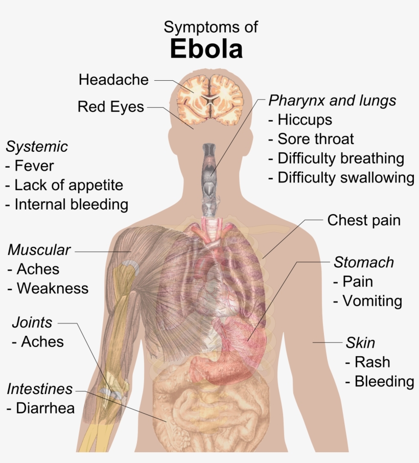Symptoms Of Ebola - Ebola Symptoms In Spanish, transparent png #1017542