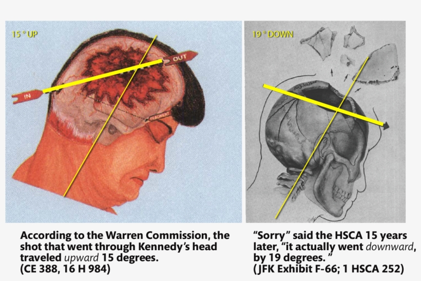 John F Kennedy Autopsy, transparent png #1019917