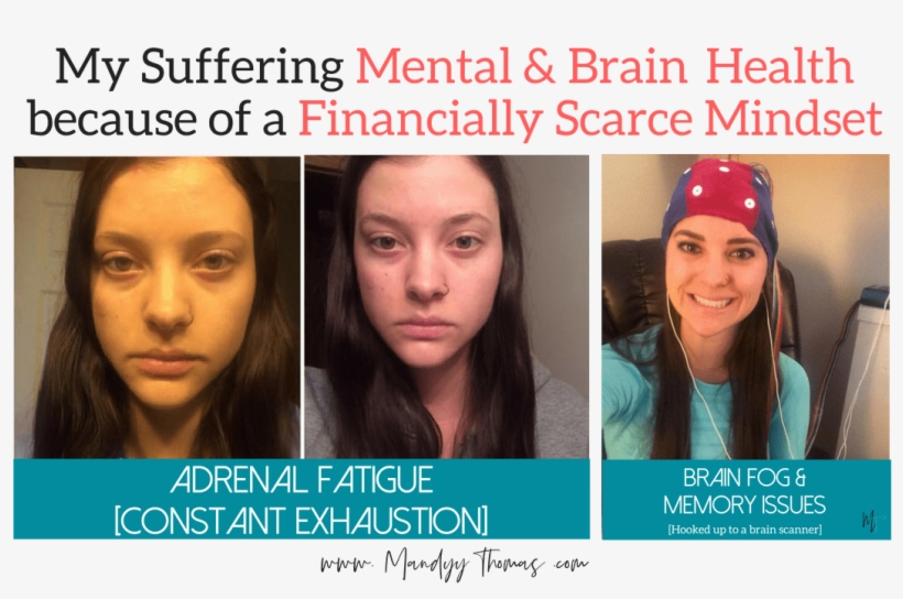 Struggling Mental Health And Anxiety Due To Financially - Photo Caption, transparent png #1028888