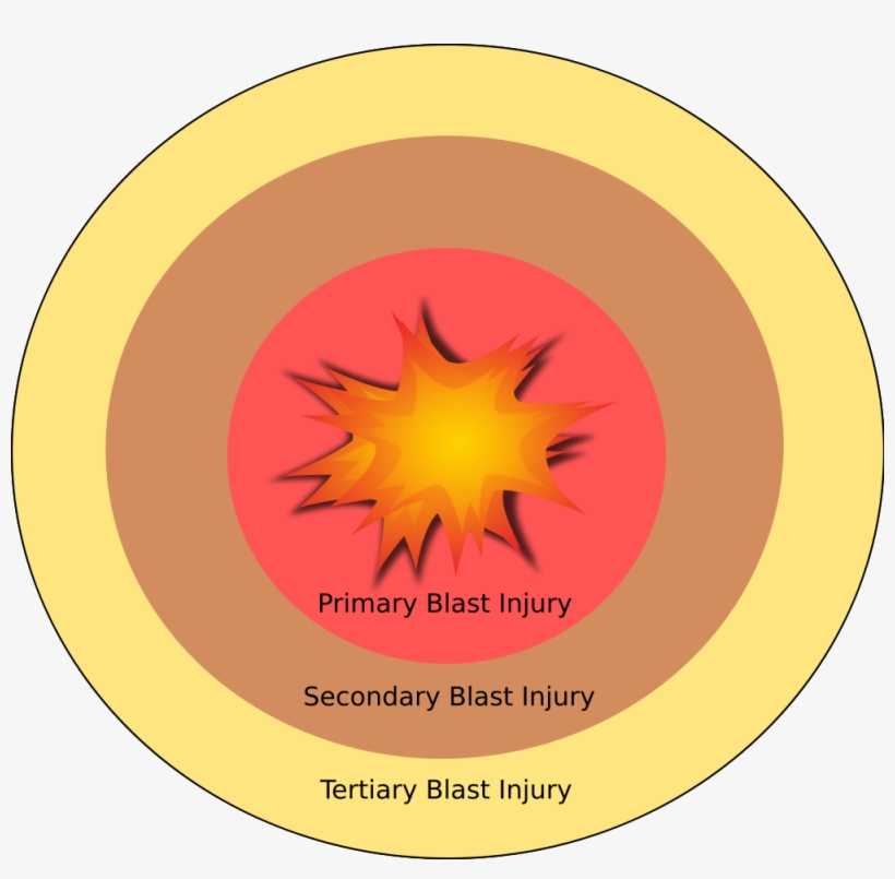 Open - Explosion Anatomy, transparent png #1030634