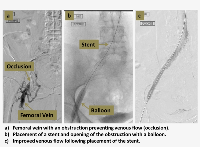 Vein, transparent png #1051702
