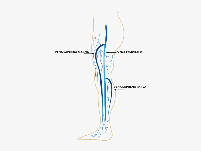 It Is Estimated That 35-60 % Of The Population Suffer - Saphena Magna Vein, transparent png #1052412