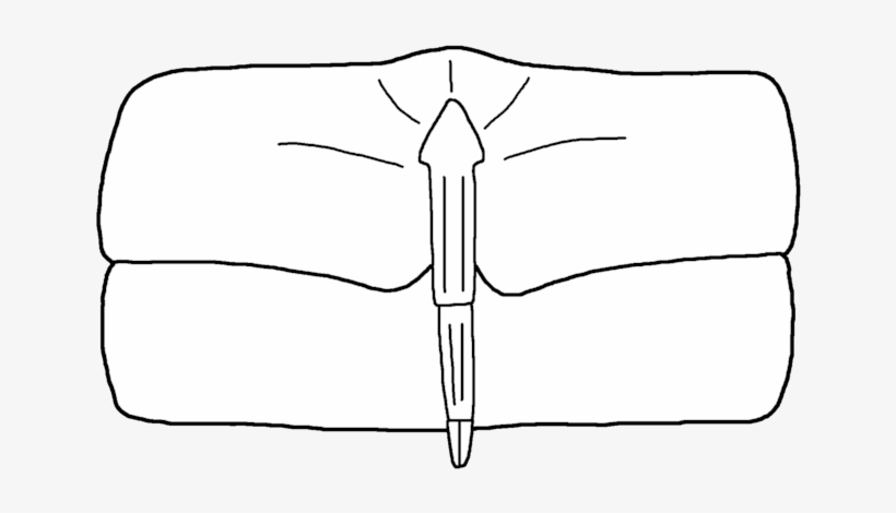 Nanahughmilleria Norvegica Genital Appendage - Illustration, transparent png #1054052
