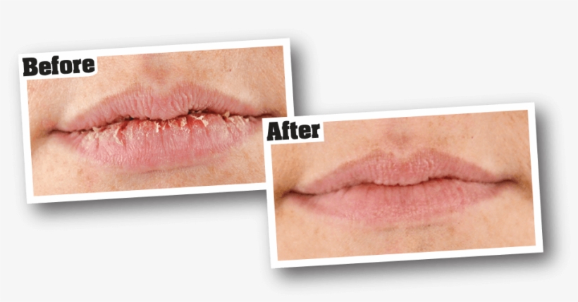 For Best Results - O Keefe Lip Repair, transparent png #1109457