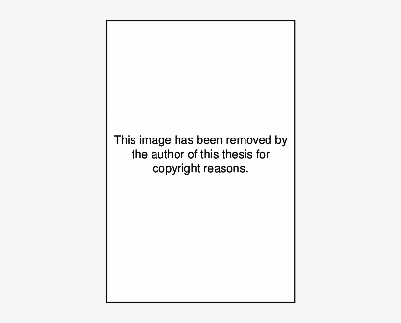 Metal Frame And Pelvic Restraint Device - Bitung, transparent png #1125749