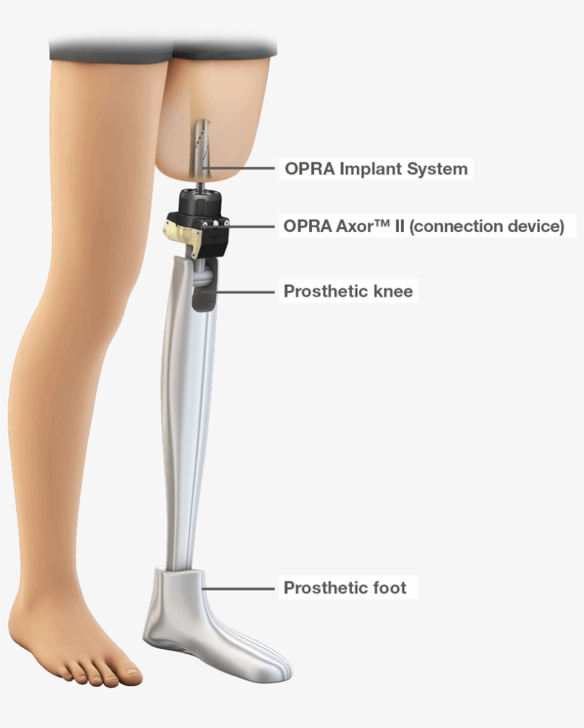 Popular Images - Amputation Prosthesis, transparent png #1130658