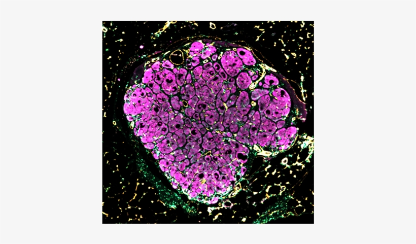 Engineered Human Liver Tissue “seeds” Blossom After - Liver, transparent png #1153638