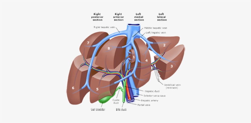 Pld Liver Resection Polycystic Liver Disease Adpld - Liver Lobes Anatomy, transparent png #1153657
