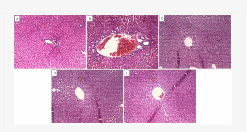 Effect Of Drug Treatment On Liver Histopathology Of - Liver, transparent png #1153758