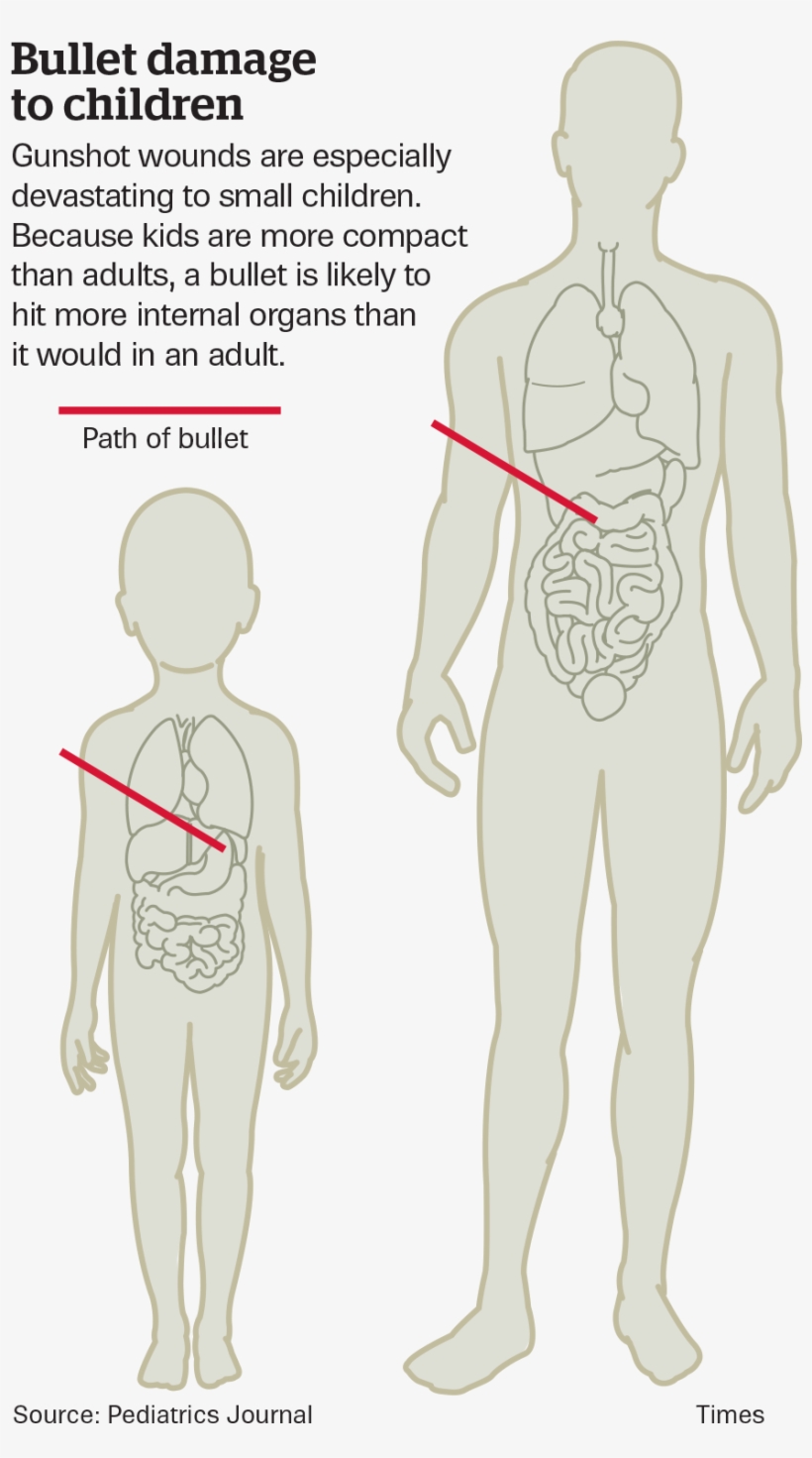 Gunshot - Children With Gunshot Wounds, transparent png #1168722