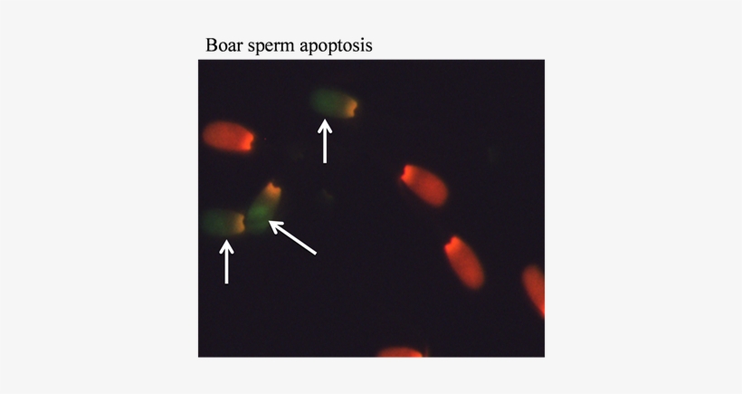 The Images Indicating The Boar Semen Apoptosis As Determined - Yo Pro 1 Sperm, transparent png #1210014
