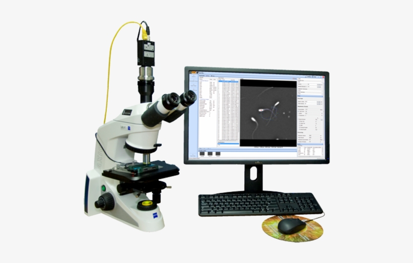 Casa Semen Analyzer - Casa Ceros Ivos Ii, transparent png #1210107