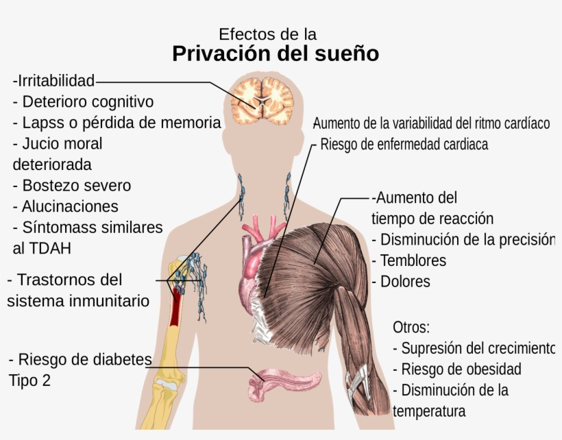 Open - Efectos De La Privación Del Sueño, transparent png #1250654