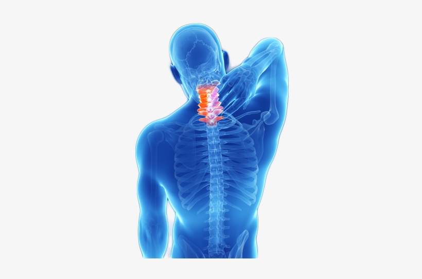 Treatment Neck Pain - Cure For Neck Pain, transparent png #1252882