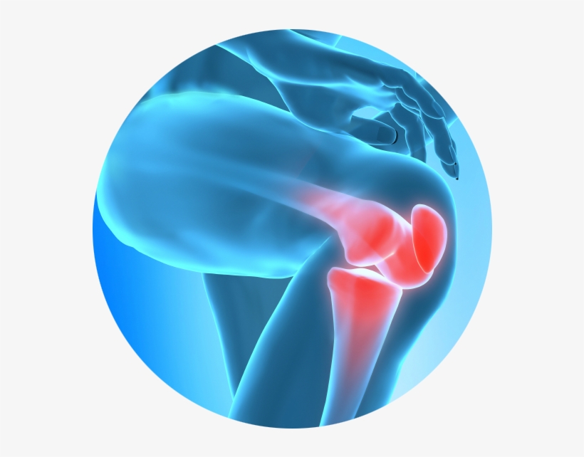 Chronic Joint Pain Slowing You Down Learn How Regenerative - Knee Pain In Png, transparent png #1253229