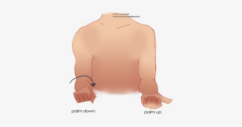 Upper Nerve 21 - Result Of Lesion Of Musculocutaneous Nerve, transparent png #1270651
