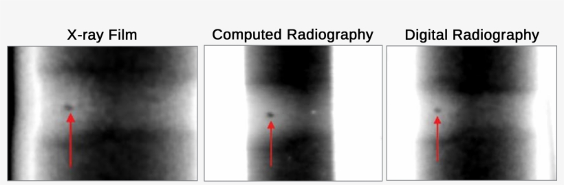 Detection Of A Pore In A Tube Weld Using X-ray Film, - Photo Caption, transparent png #1276982