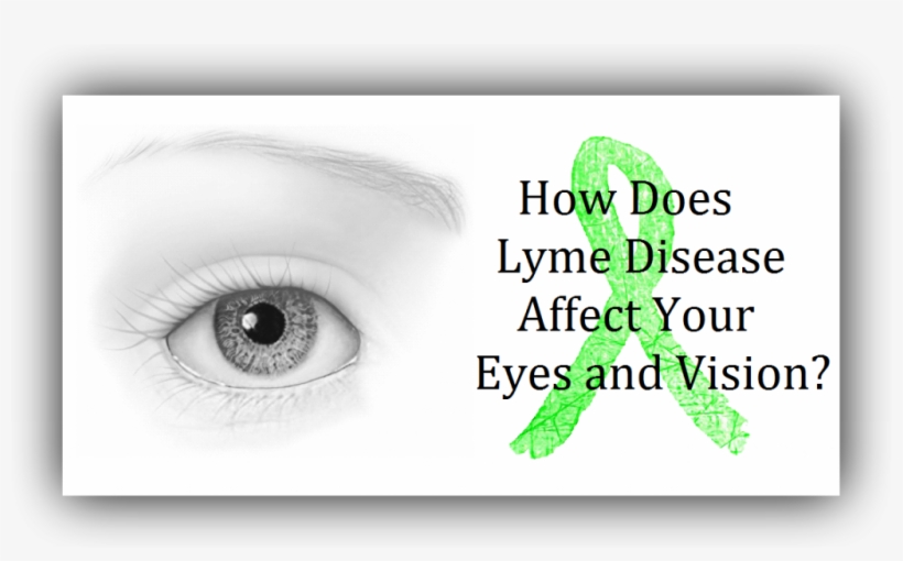 How Has Lyme Disease Affected Your Vision - Lyme Disease Eyes, transparent png #1282936