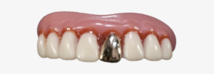 The Original Billy-bob Full Grill Gold Tooth - False Gold Teeth, transparent png #1309064