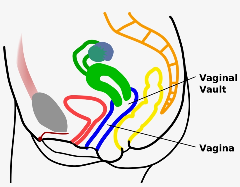 Vaginal Vault, transparent png #1399170