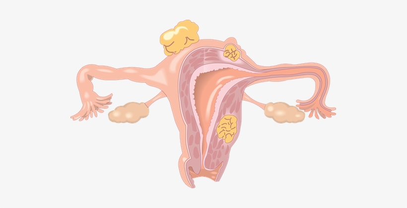 Vagina Deep - Fertility Disorder, transparent png #1400041