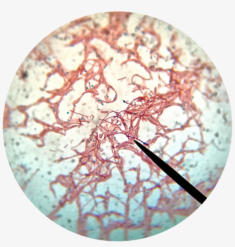 Bacillus Subtilis Endospore Stain - Endospore Stain Under Microscope, transparent png #1512402