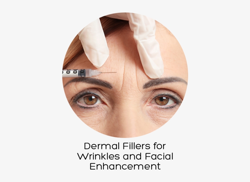 Dermal Fillers Treatment Kent, Clinics Of Dermal Filler - Wrinkle, transparent png #1627020