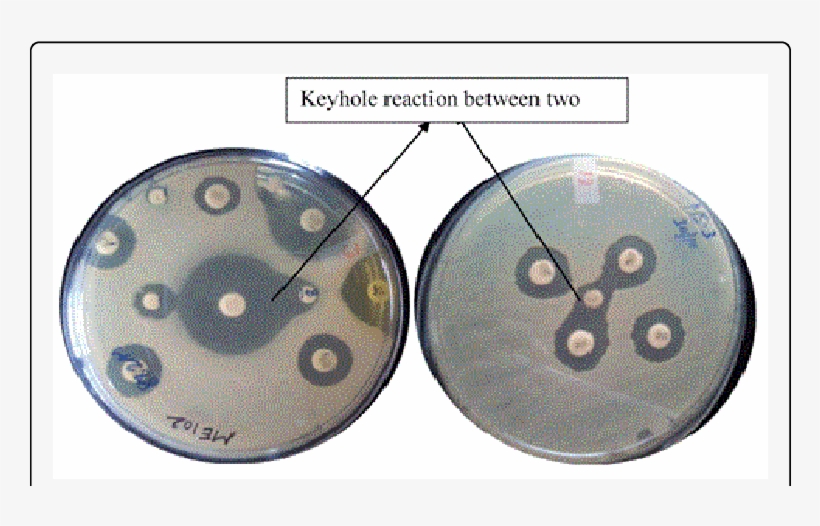Synergy Between Two Antimicrobials Indicated By Key-hole - Circle, transparent png #1630182
