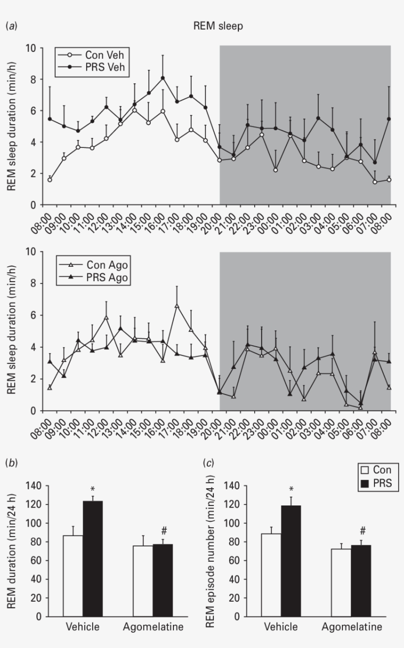 Rapid Eye Movement Sleep Profile Over 24 H - Diagram, transparent png #1630831
