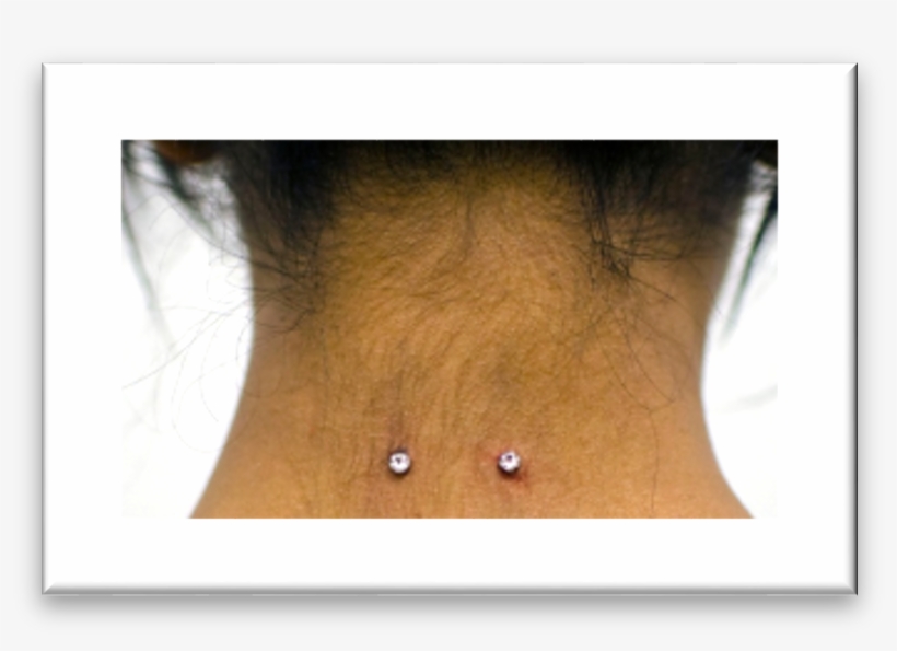 Examples Of Unacceptable Piercings - Throat, transparent png #1658667