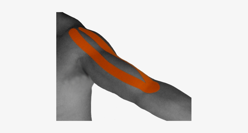 2011년 10월 20일 목요일 - Taping Biceps, transparent png #1662320