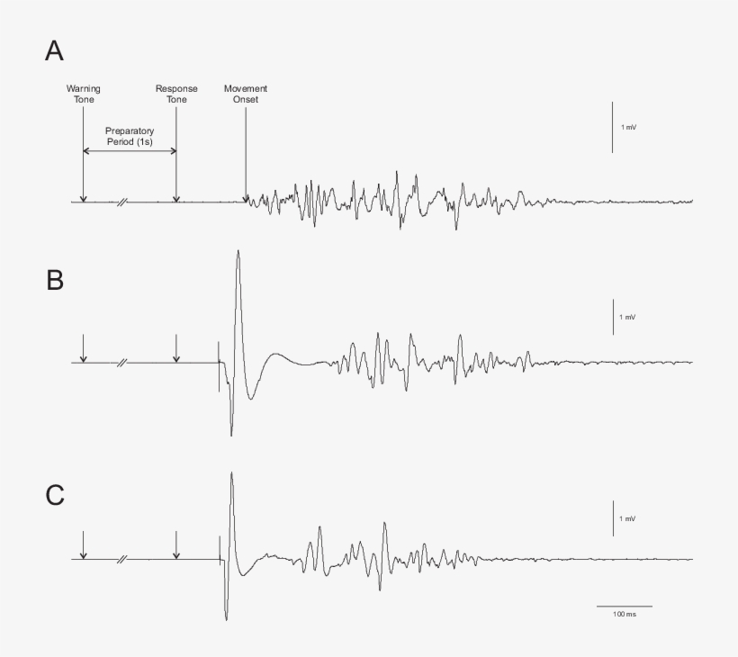 Electromyography Sample Record From The Biceps Brachii - Electromyography, transparent png #1662503