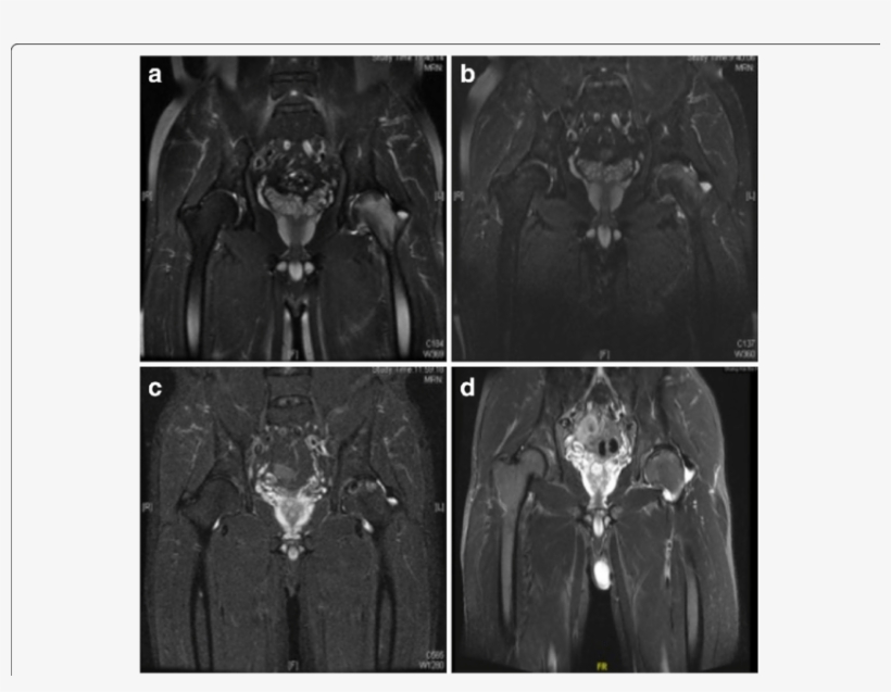 Mri Of A M - Common Fig, transparent png #1663006