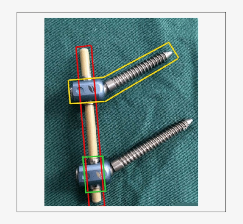 The K-rod System Used In This Study - Alloy, transparent png #1670806