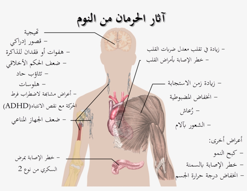 Effects Of Sleep Deprivation-ar - Healthy Lifestyle Is Important, transparent png #174970