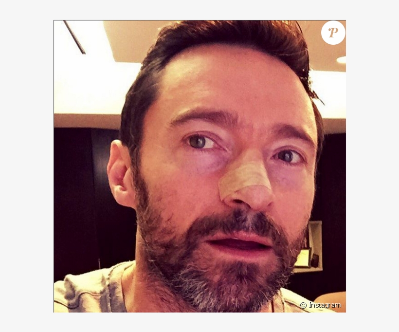 Hugh Jackman - Hugh Jackman Cancer Returns, transparent png #1708047