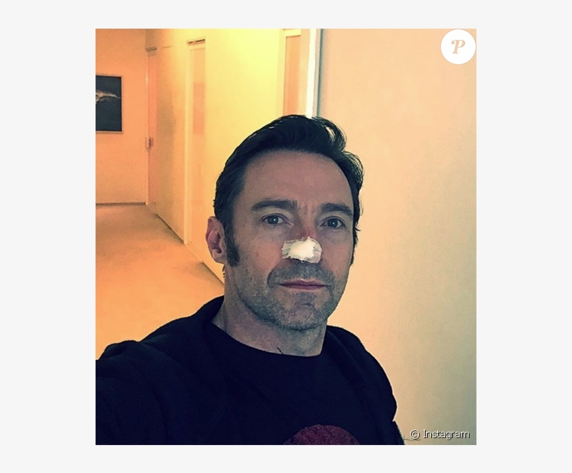 Hugh Jackman Après Une Nouvelle Opération Visant À - Michael Gracey Without Hat, transparent png #1708478