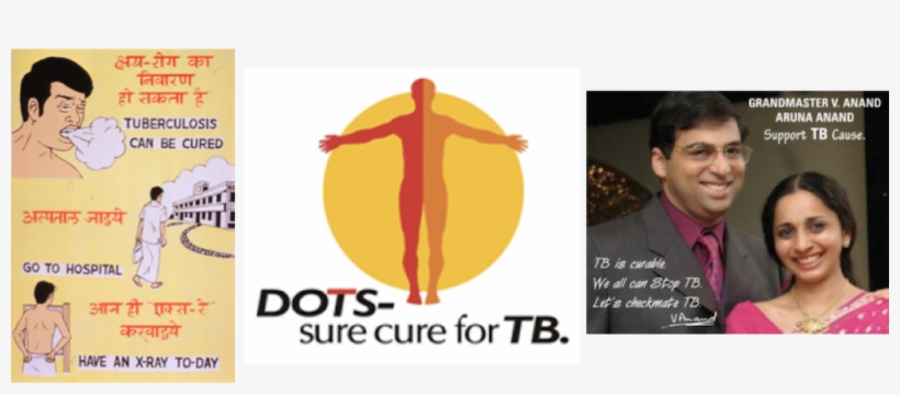 Tb Is Curable Posters - Revised National Tuberculosis Control Program, transparent png #1752521