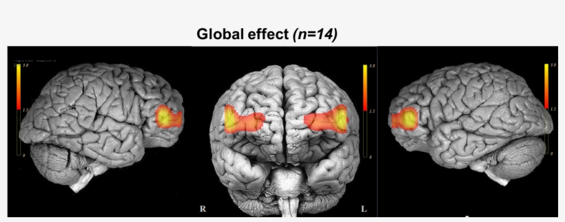 Our Approach Combines Cutting Edge Brain Imaging, Signal - Invitación A La Neurociencia [book], transparent png #1812578