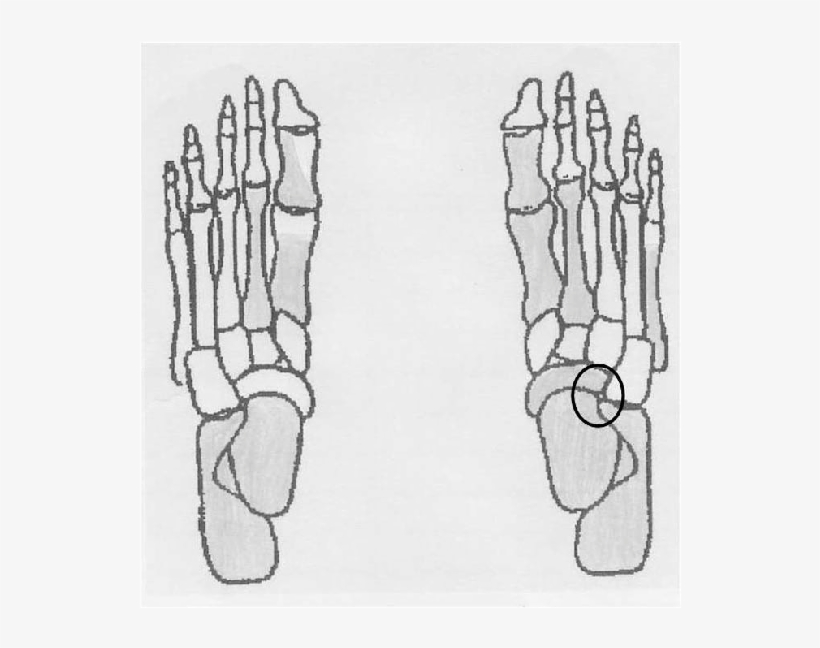 Preserved Foot Bones Of The Female Skeleton Labeled - Sketch, transparent png #1832826