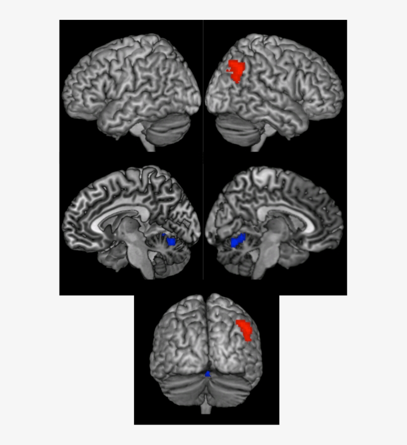Results Of The Whole Brain Searchlight Analysis Showing - Perception Of Speech: From Sound To Meaning, transparent png #1837563