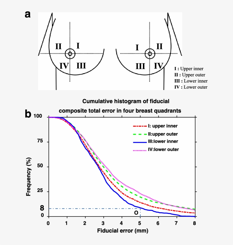 A Breast Quadrants - Quadrant Division, transparent png #1844988