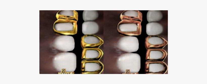 Grillz Info 💀 - Pill, transparent png #1852643