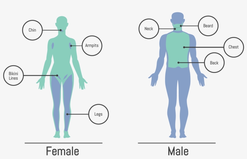 We Can Help You Remove Dark Hair From Almost Any Area - Hair, transparent png #1860607