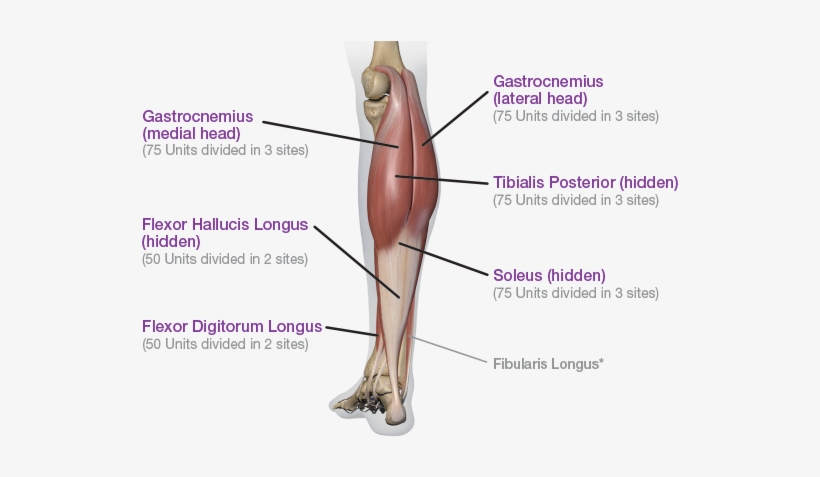 Posterior View - Lower Extremity Botox, transparent png #1871675