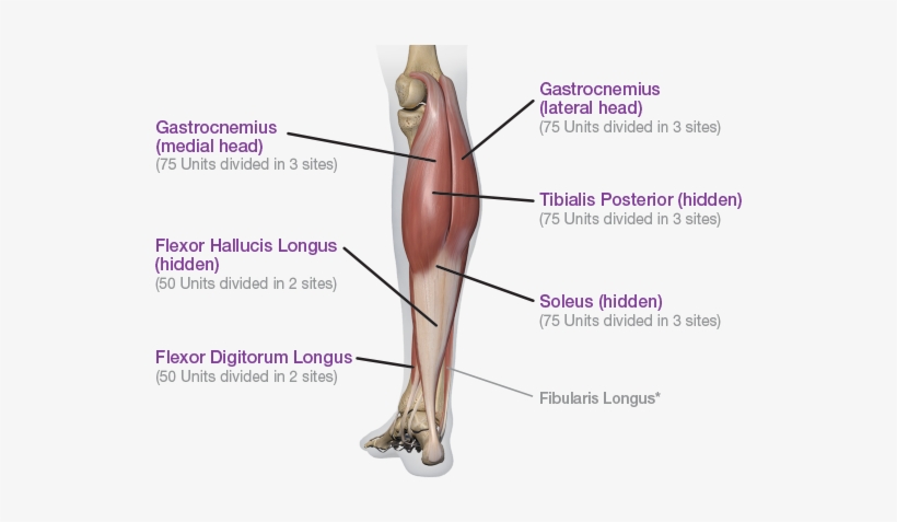 Posterior View - Lower Extremity Botox, transparent png #1871675